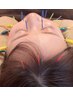 【15時16時限定】お悩み部分美容鍼（首肩頭+顔のみ）¥7,000