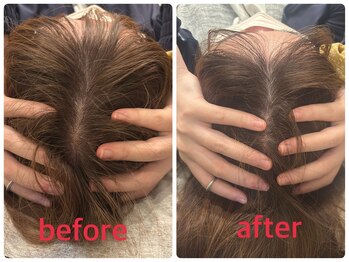 小林整骨院 本町/自律神経整え、頭と身体スッキリ