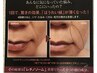 【たるみ・ほうれい線】ダイレクトパフォーマンス