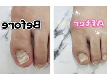 ビジューネイルズ 西川口店(bijou nails)