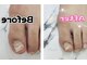ビジューネイルズ 西川口店(bijou nails)の写真/フット&ハンド同時可能 【ダメージ爪・二枚爪・表面の凹凸が気になる方へ】フット補強1本750円