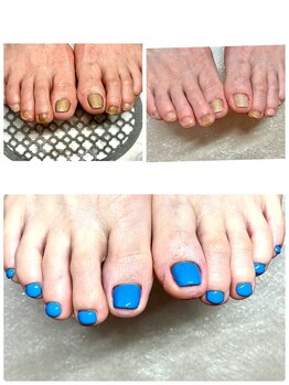 ブルーネイル(Blue Nail)の写真/お爪のコンプレックス・お悩みご相談下さい♪長くネイルを楽しんでほしい自爪想いの施術が人気の秘密☆