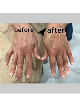 シュバル(CHEVAL)/BBLハンド♪