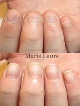 マリーロール 淀屋橋本店(Marie Laure)/自爪育成/深爪矯正/ネイルケア