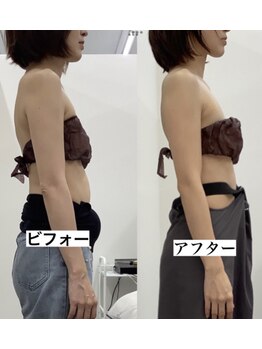 メリアミーゴ(Meli amigo)/30代女性 猫背改善・お腹