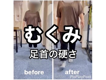 カワル整体 上通り院/むくみは足首の硬さから？