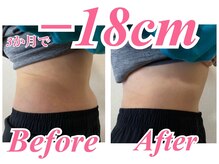 ラヴ 久屋大通店(Luv)/ゆか様BeforeAfter