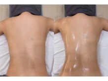 リアン 南熊本店(Lien)