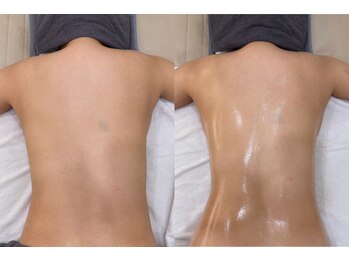 リアン 南熊本店(Lien)の写真/しぶとい脂肪を深部加熱！燃焼撃退！熊本初！マイクロ波【インコアシェイプ】で速攻★美脚へサイズダウン