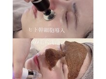 アスボーテ 月島(As Beaute’)の雰囲気(韓国式3D毛穴洗浄で毛穴汚れを徹底除去!+イオンザイム導入効果UP)