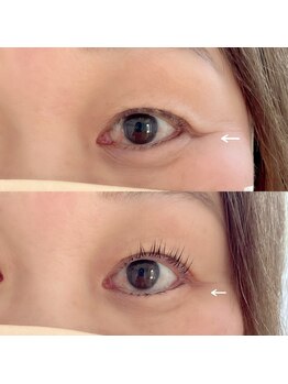 ブリリーアイ サロン(brilieye salon)/目が開けやすくなる事で!