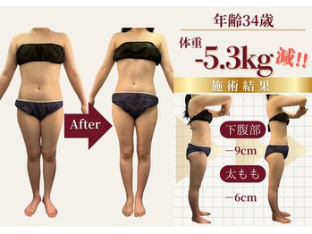 ザ ラウラ ビューティー ボディ(THE LAULA BEAUTY)/34歳【ブライダル】