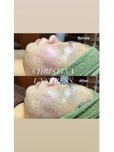 マリー(Mary.)/クリスティーナ・アンストレス