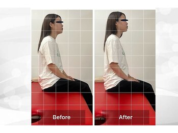 ナオル整体 浦添院(NAORU整体)/沖縄県/浦添/肩こり/整体/腰痛