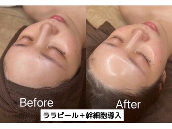 マドモアゼル 麻布十番