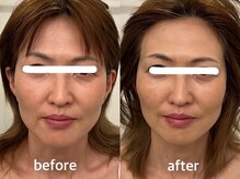 ヴィセラ(Vicella)/50代の美魔女