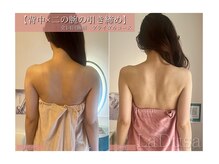 ラ ドゥーサ(La Dusa)/背中×二の腕の引き締めに☆