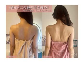 ラ ドゥーサ(La Dusa)/背中×二の腕の引き締めに☆