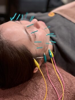 えにし整体 鍼灸整骨院/一番の人気メニュー!!