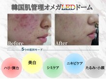 シュシュ(chou chou)