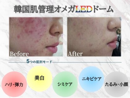 シュシュ(chou chou)の写真