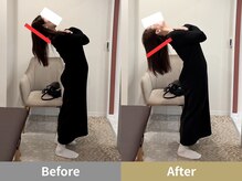 せなかのはね 井尻店/30代　猫背　ストレートネック