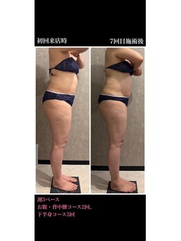 トータルビューティー ミミ(Total Beauty mimi)/週3ペースで太ももスッキリ!!