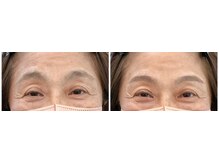 スム(SUMU)の雰囲気（作り込みすぎず、今の自分に似合う眉へ）