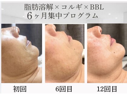 モミン(MOMI.N)の写真