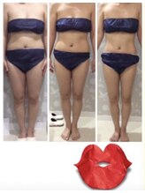 カラット(CARAT)/お客様のビフォーアフター一例