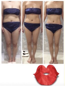 カラット(CARAT)/お客様のビフォーアフター一例