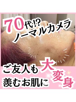 ホワイトワックス 名古屋金山店(WHITE WAX)/10代～70代まで通われています♪