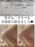 人気NO.2【いちご鼻/産毛/お肌の大掃除！！】毛穴デトックスコース(120分)
