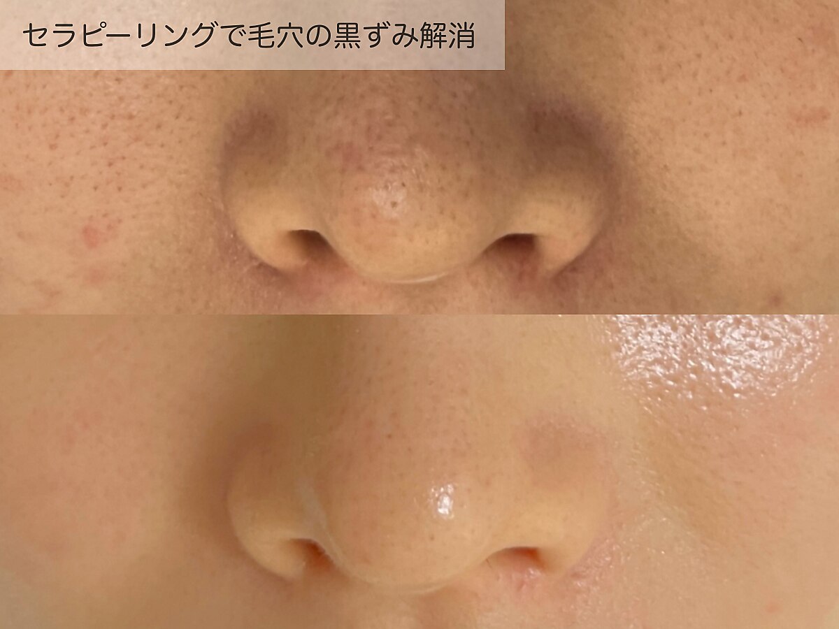 Speciality Salon K@O ｜目的のある美の追求 - 麻布十番のエステ