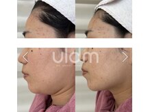 ミリ サロン(Milli Salon)