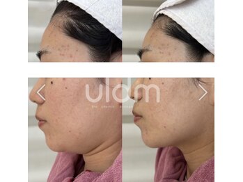 ミリ サロン(Milli Salon)