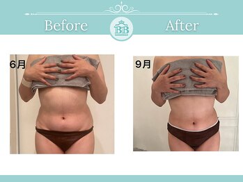 美人バスト 犬山店/【お腹引き締め】症例