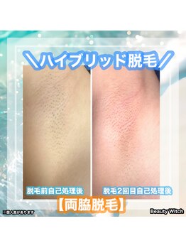 ビューティ ウィッチ(Beauty Witch)/