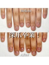 リリー/深爪もこんなに縦長に