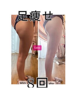 キャルム/ハイパーナイフ美脚コース