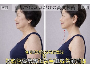 サロンチオリ 烏丸(Salon Chiori)/人生痩せたことがない方に効果