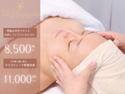 イエローウィーン(YELLOWEEN.)の写真