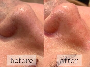 グランビューティ(Glanz Beauty)/40代男性