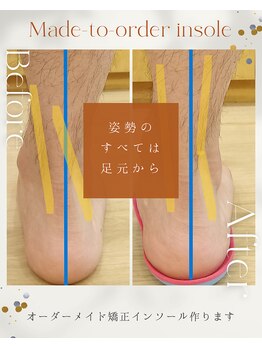 整骨院リライフ 西原店(Re.life)の写真/何となく体がキツイ！そのお悩み足元から来てるかも？インソール療法で解決！まずは体験施術ケア指導まで◎