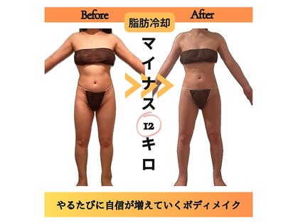 エステティックサロン フェアリー(ESTHETIC SALON FAIRLY)の写真