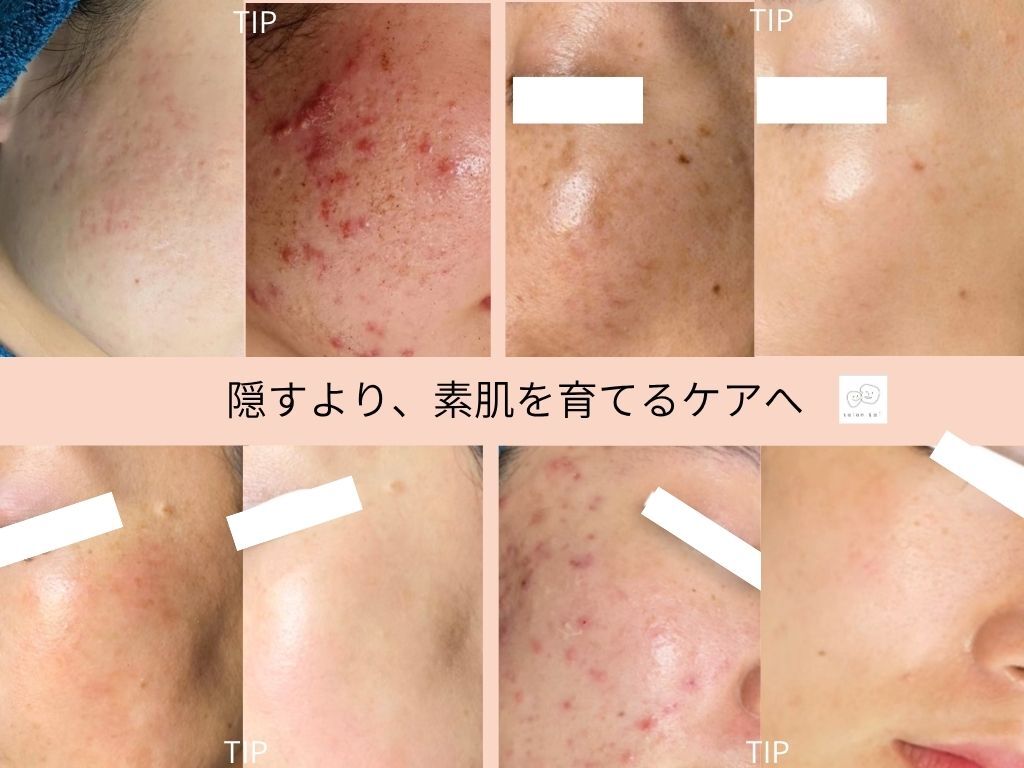 サロンサイ(salonsai)｜ホットペッパービューティー