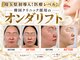 ジェムスキンラボ 所沢店(GEM SKIN LAB)の写真/《埼玉唯一の韓国製オンダ導入店★》若い頃と違うもたつき・二重アゴに！とにかく小顔になりたい方向け！