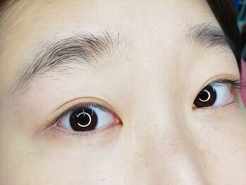 アイフラッシュ 京阪百貨店くずはモール店(Eye Flash)/ビフォー