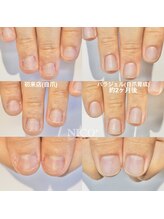 ニコプラス(NICO+)/自爪育成中