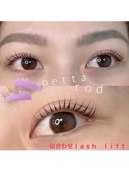 アーラ(Alas)/似合わせまつパデザイン